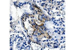 IHC analysis of Pecam1 using anti-Pecam1 antibody (ABIN7601672).