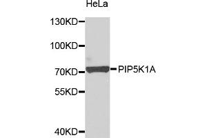 Western blot analysis of extracts of HeLa cells, using PIP5K1A antibody (ABIN5975757) at 1/1000 dilution.