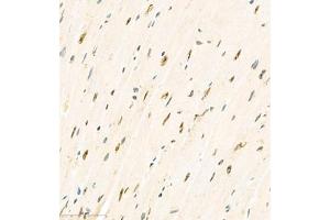 Immunohistochemistry analysis of paraffin embedded mouse heart using KCNIP3 (ABIN7073771) at dilution of 1: 2000 (DREAM antibody)