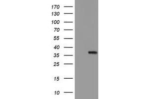 HEK293T cells were transfected with the pCMV6-ENTRY control (Left lane) or pCMV6-ENTRY MLF1 (Right lane) cDNA for 48 hrs and lysed. (MLF1 antibody)