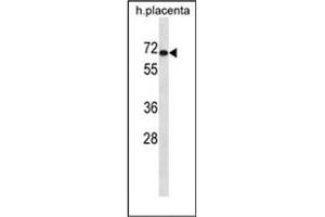 Western blot analysis of LZTS1 Antibody (N-term) in human placenta tissue lysates (35ug/lane).