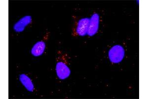 Proximity Ligation Analysis of protein-protein interactions between STAT5A and GHR. (Growth Hormone Receptor antibody  (AA 19-118))