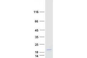 T-Cell Acute Lymphocytic Leukemia 2 (TAL2) protein (Myc-DYKDDDDK Tag)