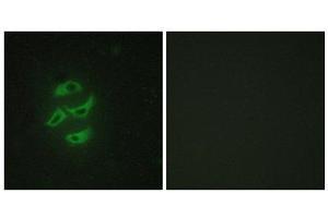Immunofluorescence (IF) image for anti-Cytochrome P450, Family 2, Subfamily J, Polypeptide 2 (CYP2J2) (Internal Region) antibody (ABIN1850360) (CYP2J2 antibody  (Internal Region))