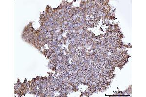 IHC analysis of SNAP23 using anti-SNAP23 antibody (ABIN7599089). (SNAP23 antibody  (AA 1-211))