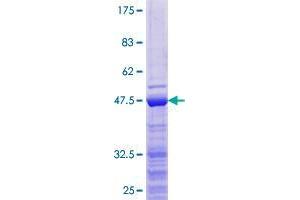 ZCCHC13 Protein (AA 1-166) (GST tag)