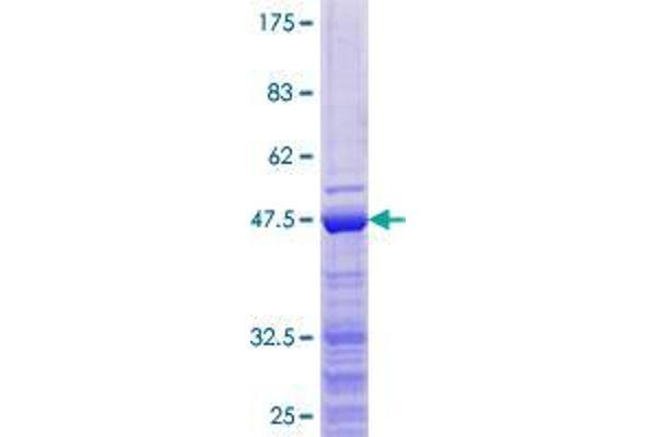 ZCCHC13 Protein (AA 1-166) (GST tag)