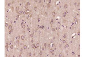 Paraformaldehyde-fixed, paraffin embedded Rat brain Antigen retrieval by boiling in sodium citrate buffer (pH6. (TRIM23 antibody  (AA 201-300))