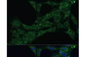 Immunofluorescence analysis of C6 cells using ETFB Polyclonal Antibody at dilution of 1:100 (40x lens). (ETFB antibody)
