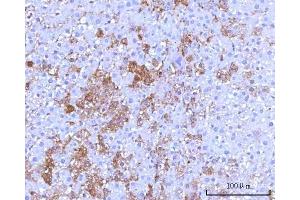 IHC analysis of RPS25 using anti-RPS25 antibody (ABIN7601567). (RPS25 antibody  (AA 39-125))