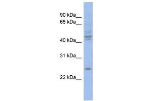 WB Suggested Anti-PROP1  Antibody Titration: 0. (PROP1 antibody  (Middle Region))