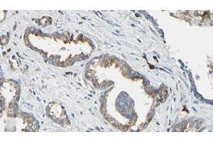 ABIN6268850 at 1/100 staining Human prostate tissue by IHC-P. (DCT antibody  (N-Term))