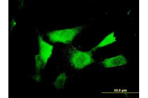 Immunofluorescence of monoclonal antibody to NAAA on NIH/3T3 cell. (NAAA antibody  (AA 36-104))