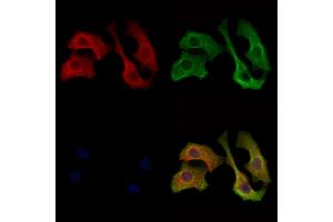 ABIN7093182 and ABIN7101266 staining Hela cells by IF/ICC.