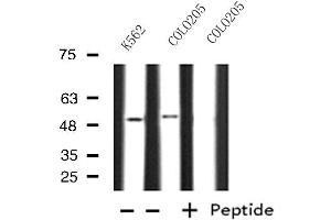 Western blot analysis of extracts from K562/COLO205 cells, using OAT antibody.