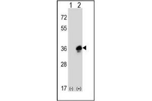 Western blot analysis of MPZ Antibody (C-term) . (MPZ antibody  (C-Term))