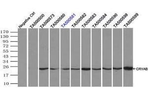 Image no. 3 for anti-Crystallin, alpha B (CRYAB) antibody (ABIN1497644) (CRYAB antibody)