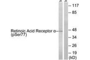 Western blot analysis of extracts from Jurkat cells treated with PMA 125ng/ml 30' and Jurkat cells treated with insulin 0. (Retinoic Acid Receptor alpha antibody  (pSer77))