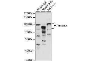 Western blot analysis of extracts of various cell lines, using TMPRSS7 antibody (ABIN7270949) at 1:1000 dilution. (TMPRSS7 antibody  (AA 478-717))