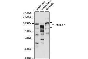 Western blot analysis of extracts of various cell lines, using TMPRSS7 antibody (ABIN7270949) at 1:1000 dilution.