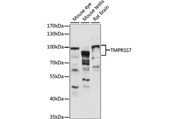 TMPRSS7 抗体  (AA 478-717)