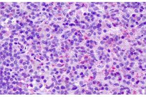 Anti-CCR7 antibody IHC staining of human spleen. (CCR7 antibody  (C-Term))