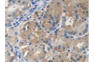 DAB staining on IHC-P; Samples: Human Stomach Tissue (SCARA5 antibody  (AA 118-495))