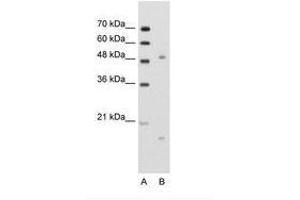 Image no. 1 for anti-Integrin, beta-Like 1 (With EGF-Like Repeat Domains) (ITGBL1) (N-Term) antibody (ABIN203507)