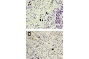 Fig. (CEACAM1 antibody)