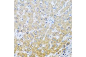 Immunohistochemistry of paraffin-embedded human liver using IL20 antibody (ABIN6128133, ABIN6142353, ABIN6142354 and ABIN6222322) at dilution of 1:100 (40x lens). (IL-20 antibody  (AA 25-176))