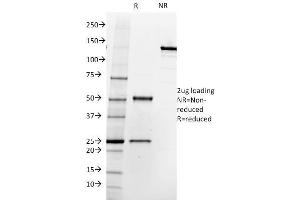 SDS-PAGE Analysis Purified FOLH1 (PSMA) Mouse Monoclonal Antibody (SPM500). (PSMA antibody  (AA 232-433))