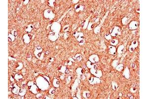 Immunohistochemistry of paraffin-embedded human brain tissue using ABIN7150398 at dilution of 1:100 (IGHMBP2 antibody  (AA 646-884))