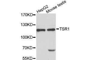 Western blot analysis of extracts of various cell lines, using TSR1 antibody (ABIN6293796) at 1:3000 dilution. (TSR1 antibody)