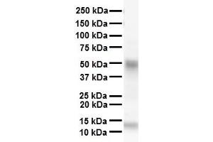 WB Suggested Anti-SMAD6 antibody Titration: 1 ug/mL Sample Type: Human heart (SMAD6 antibody  (N-Term))