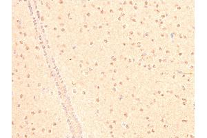 Immunohistochemistry (IHC) image for anti-Tumor Protein P53 (TP53) (acLys319) antibody (ABIN6254862)