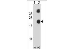 Western blot analysis of DSTN (arrow) using rabbit polyclonal DSTN Antibody (Center) (ABIN653136 and ABIN2842712). (Destrin antibody  (AA 70-98))