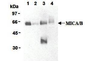 Western Blotting (WB) image for anti-MHC Class I Polypeptide-Related Sequence A (MICA) antibody (ABIN1108244) (MICA antibody)