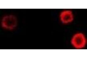 Immunofluorescent analysis of Epsilon-sarcoglycan staining in Hela cells. (SGCE antibody)