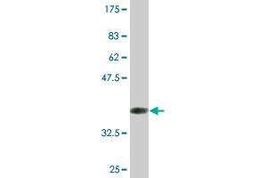 Western Blot detection against Immunogen (36. (ARNT2 antibody  (AA 464-563))