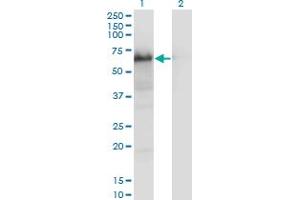 Western Blot analysis of YAP1 expression in transfected 293T cell line by YAP1 monoclonal antibody (M01), clone 2F12. (YAP1 antibody  (AA 53-161))
