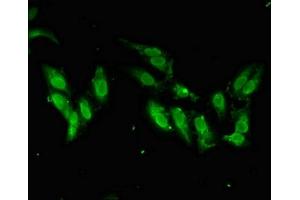 Immunofluorescent analysis of Hela cells using ABIN7171062 at dilution of 1:100 and Alexa Fluor 488-congugated AffiniPure Goat Anti-Rabbit IgG(H+L) (SMARCAL1 antibody  (AA 6-277))