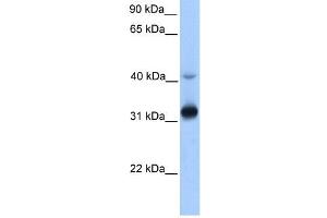 GPSN2 antibody used at 1 ug/ml to detect target protein. (TECR antibody  (Middle Region))
