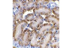 Immunohistochemical staining of CAD in mouse kidney tissue with CAD antibody at 2μg/ml.