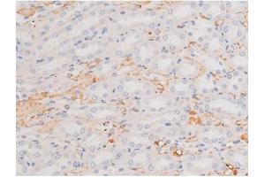 ABIN6267364 at 1/200 staining Rat kidney tissue sections by IHC-P.