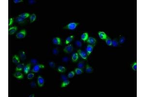 Immunofluorescence staining of Hela cells with ABIN7158282 at 1:100, counter-stained with DAPI. (CD47 antibody  (AA 44-141))