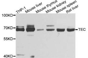 Western blot analysis of extracts of various cell lines, using TEC antibody. (NR4A3 antibody  (AA 1-280))