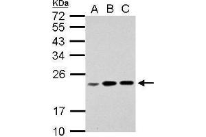 WB Image Sample (30 ug of whole cell lysate) A: Jurkat B: Raji C: K562 12% SDS PAGE antibody diluted at 1:1000 (RPL17P7 antibody  (Center))