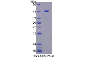 SDS-PAGE (SDS) image for Fasciculation and Elongation Protein zeta 2 (Zygin II) (FEZ2) (AA 1-375) protein (His tag) (ABIN4989739) (FEZ2 Protein (AA 1-375) (His tag))