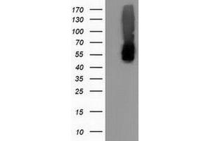 Western Blotting (WB) image for anti-Calcium Binding and Coiled-Coil Domain 2 (CALCOCO2) antibody (ABIN1497075)