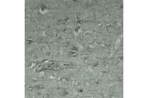 IHC on mouse brain (cryo section) using Rabbit antibody to Synaptotagmin 17  at a concentration of 50 µg/ml incubated overnight at 4C. (SYT17 antibody  (Internal Region))